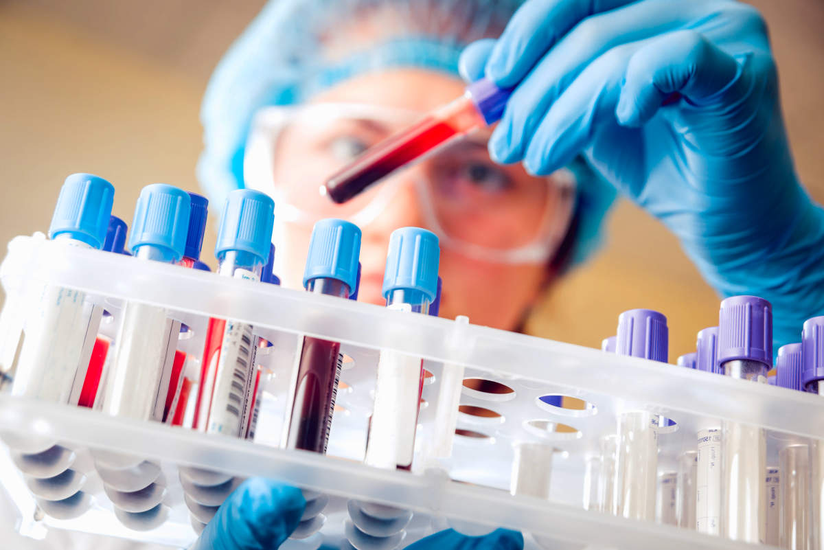 Medical equipment. Blood test | Premenopause | Perimenopause Symptoms and What To Expect