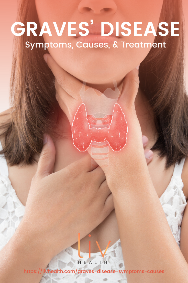 Graves&rsquo; Disease Symptoms, Causes, And Treatment https://livhealth.com/graves-disease-symptoms-causes/