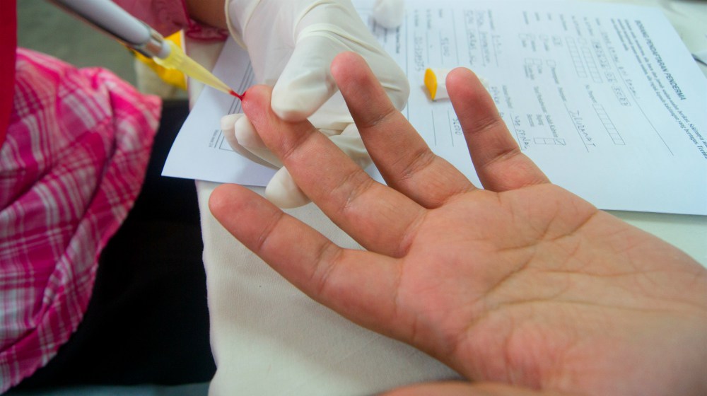 person having tested for sugar level | Hashimoto Thyroiditis Treatment | Take Care Of Your Liver To Treat The Disease | hashimoto thyroiditis | hashimoto's thyroiditis diagnosis