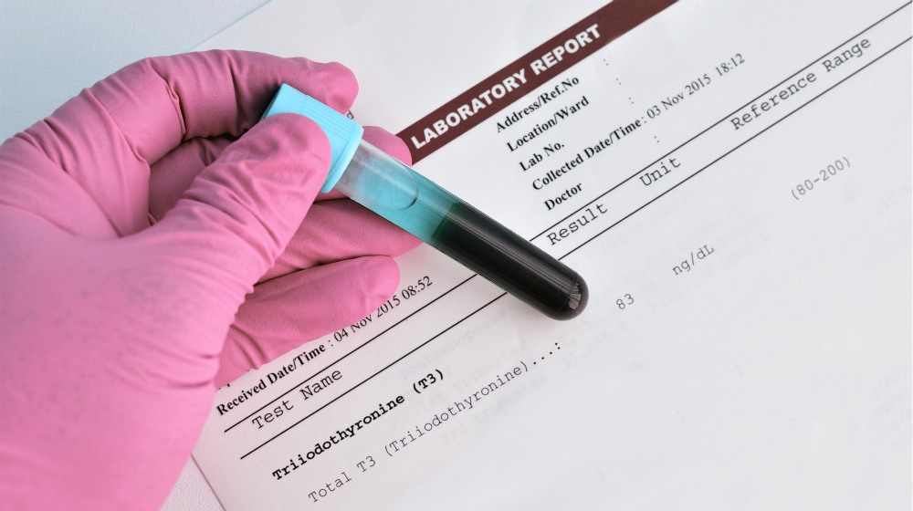 blood sample thyroid hormone t3 result | Thyroid Pooling: Symptoms, Causes, and Treatments | thyroid pooling | stop the thyroid madness